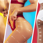 BBL (Brazilian Butt Lift) 7