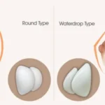 BREAST IMPLANT 5