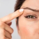 Brow Lift 5