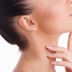 Chin Liposuction 3