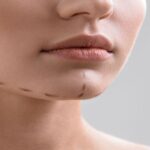 Close up of female chin with correction lines before surgery treatment. Isolated