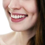 Dimple Creation 3