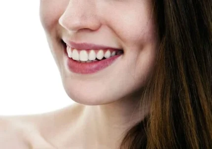 Dimple Creation 3