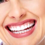 Emax Veneer Crown 3