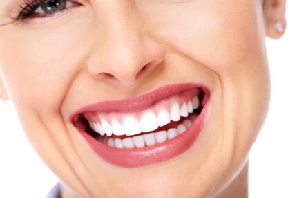Emax Veneer Crown 3