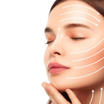Facelift 6