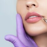 Lip Aesthetics 1
