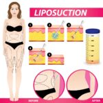 Liposuction 5