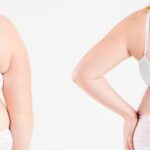 Liposuction 6