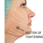 Necklift 2
