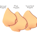 Nipple Aesthetics 2