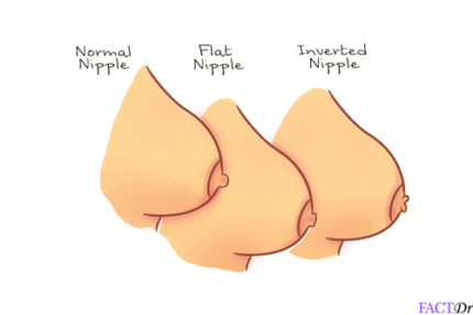 Nipple Aesthetics 2