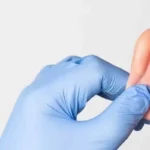 Otoplasty 2