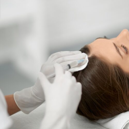 PRP and Mesotherapy 4