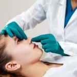 Rhinoplasty 4