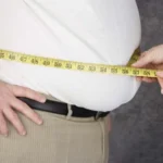 Sleeve Gastrectomy 5