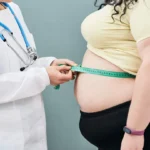 Sleeve Gastrectomy 8