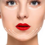 Thread Lift 1