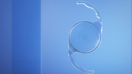Trifocal IOL2