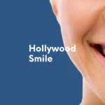 hollywood smile4