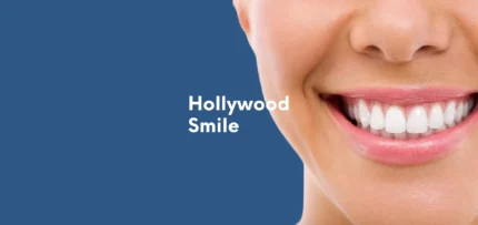 hollywood smile4