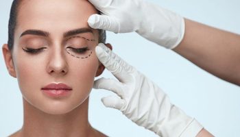Blepharoplasty 1