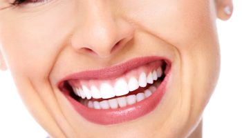 Emax Veneer Crown 3