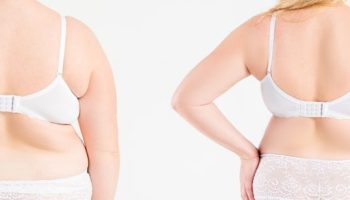 Liposuction 6