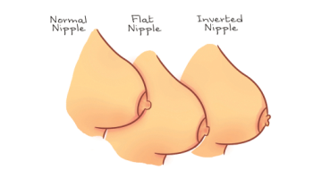 Nipple Aesthetics 2