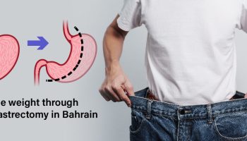 Sleeve Gastrectomy 3