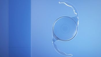 Trifocal IOL2