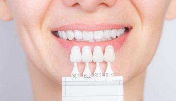 Zirconium Veneer Crown 3