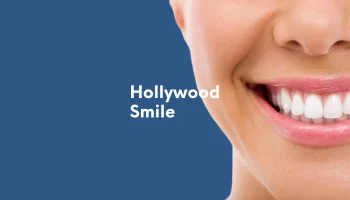 hollywood smile4
